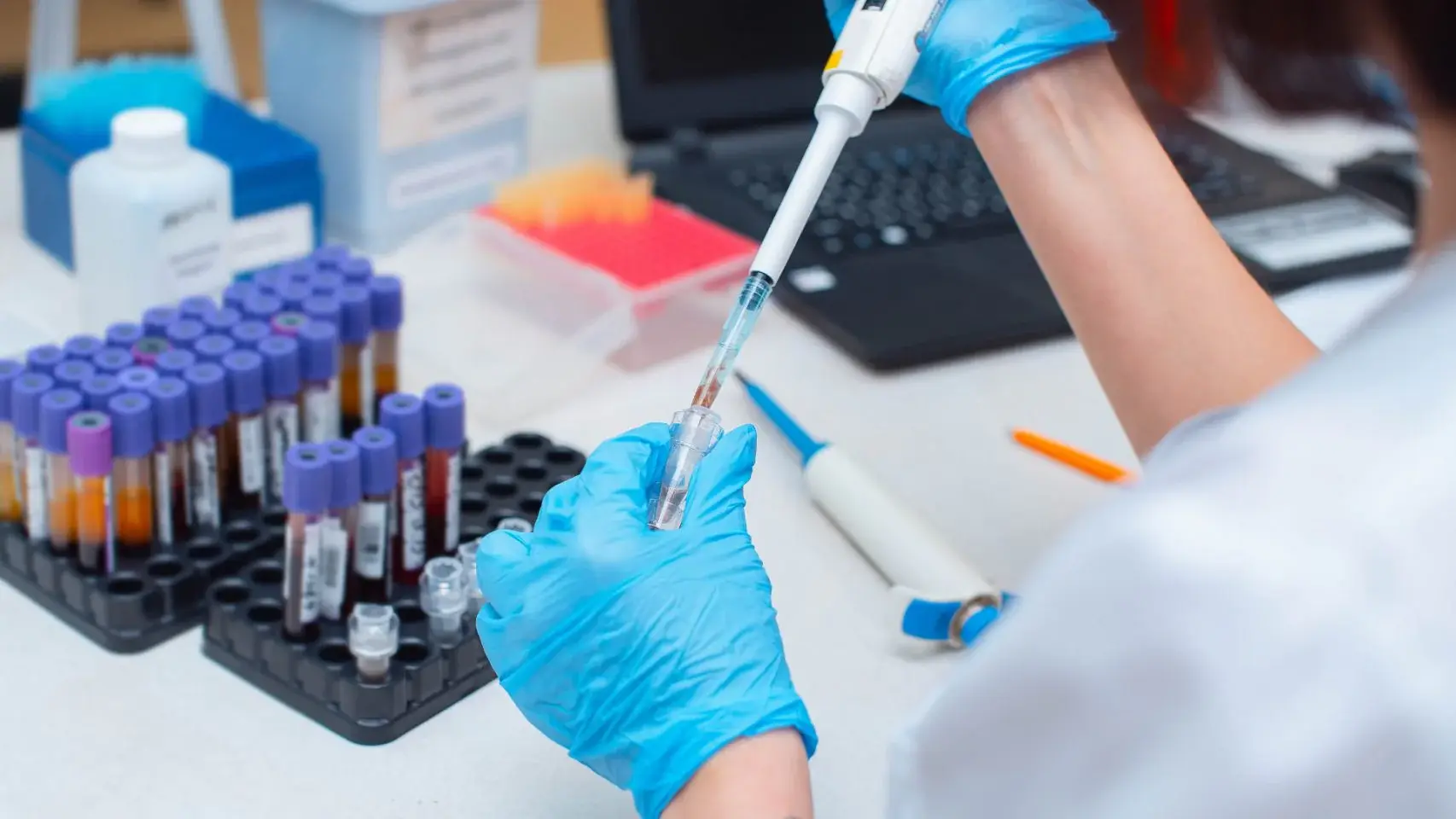 Procesamiento de muestras de sangre con micropipeta en un laboratorio clínico
